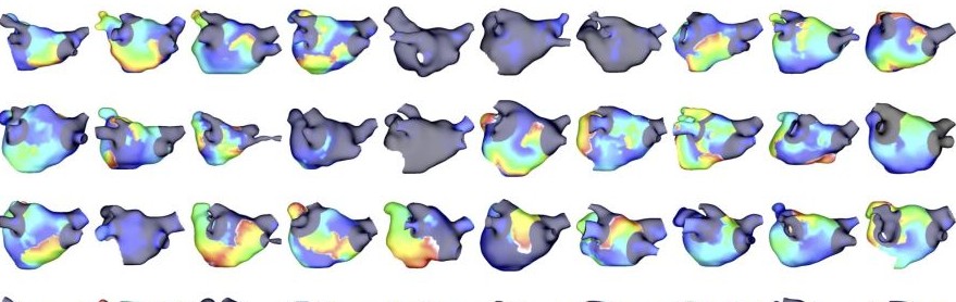 Cardiac modelling using AI
